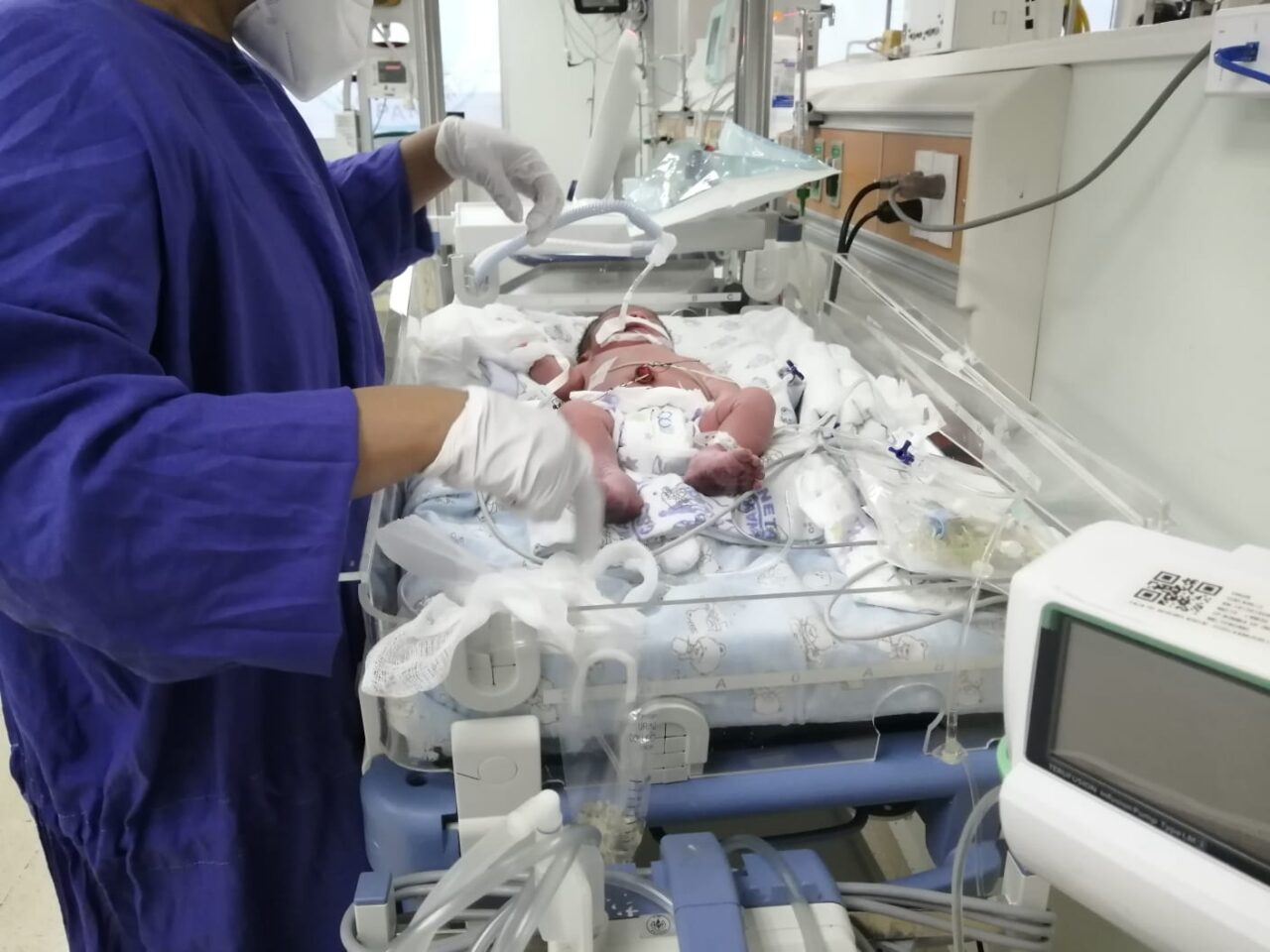 Adelle, la bebé prematura que estuvo en cuidados intensivos durante 96 días